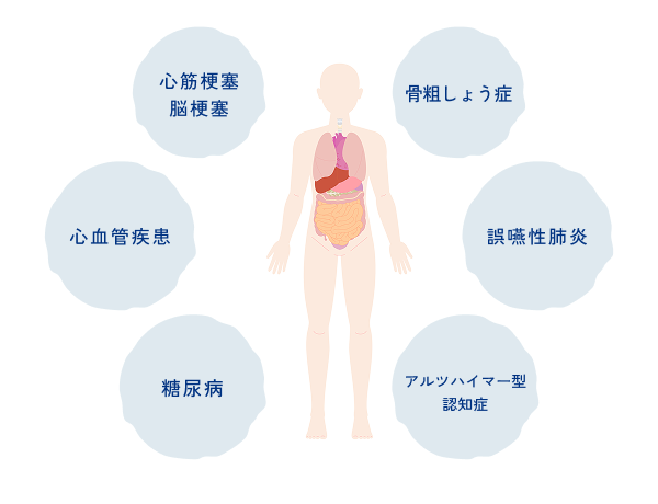 歯周病治療 イメージ